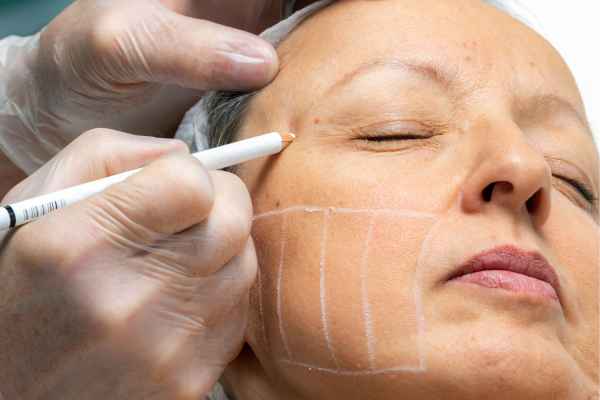 CryoPen: 5 Skin Concerns It May Be Used to Treat 4 What should you ask before having CryoPen treatment Northampton?
