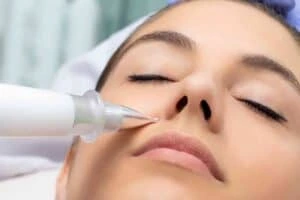 Best Actinic Keratoses Removal 3 Actinic keratoses Northampton solutions - book in today!